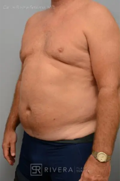 Before Results